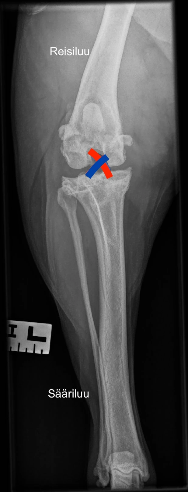 Polven anatomia edestä